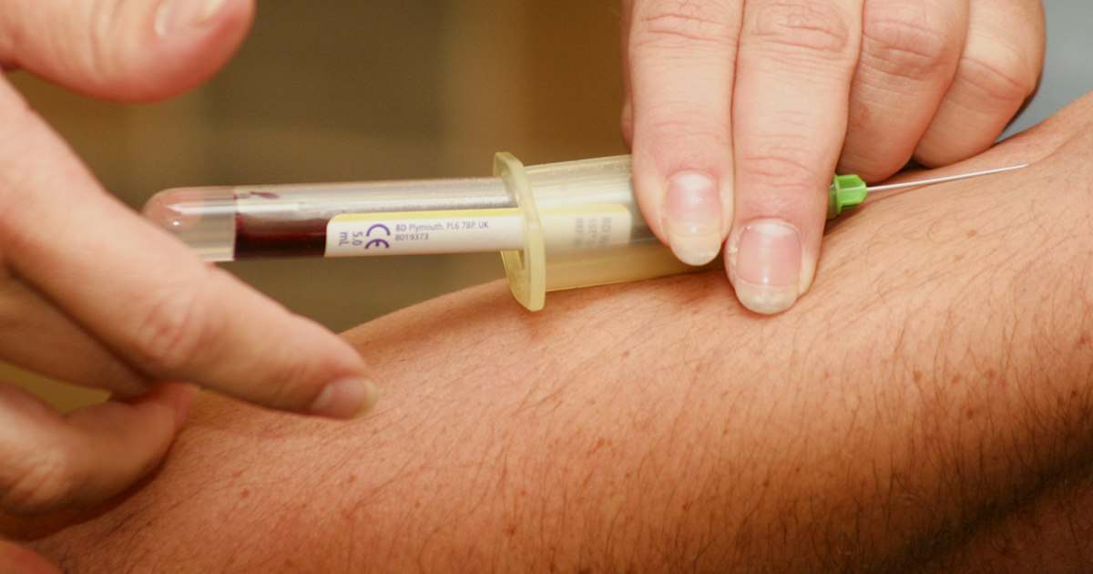 Wie man sich auf den Estradiol-Test vorbereitet: Regeln zur Blutentnahme